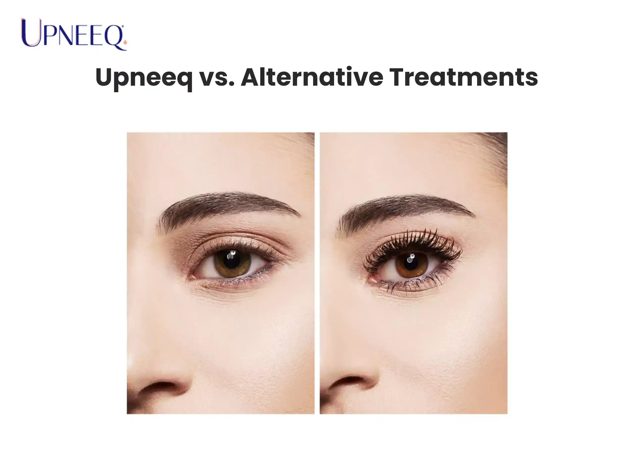Upneeq vs. Alternative Treatments
