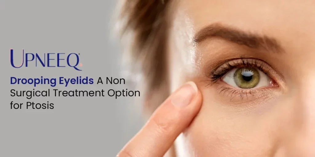 Drooping Eyelids: A Non-Surgical Treatment Option for Ptosis