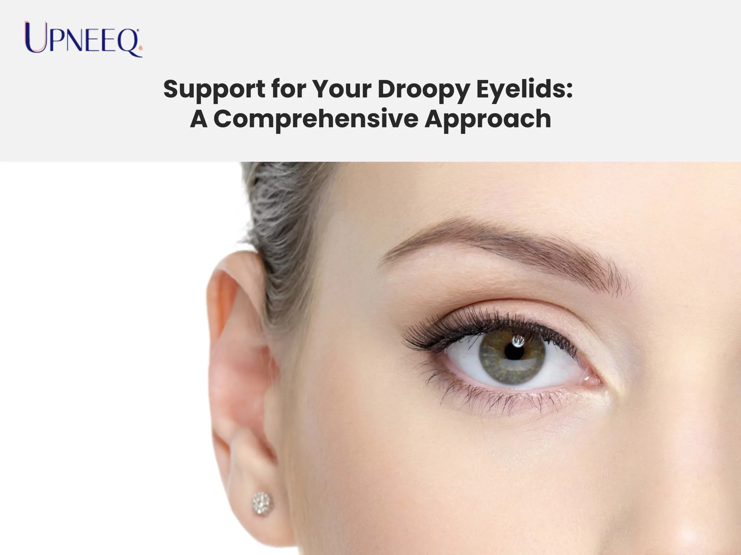 Support for Your Droopy Eyelids: A Comprehensive Approach