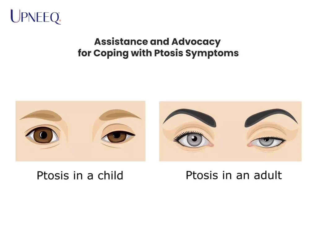 Assistance and Advocacy for Coping with Ptosis Symptoms