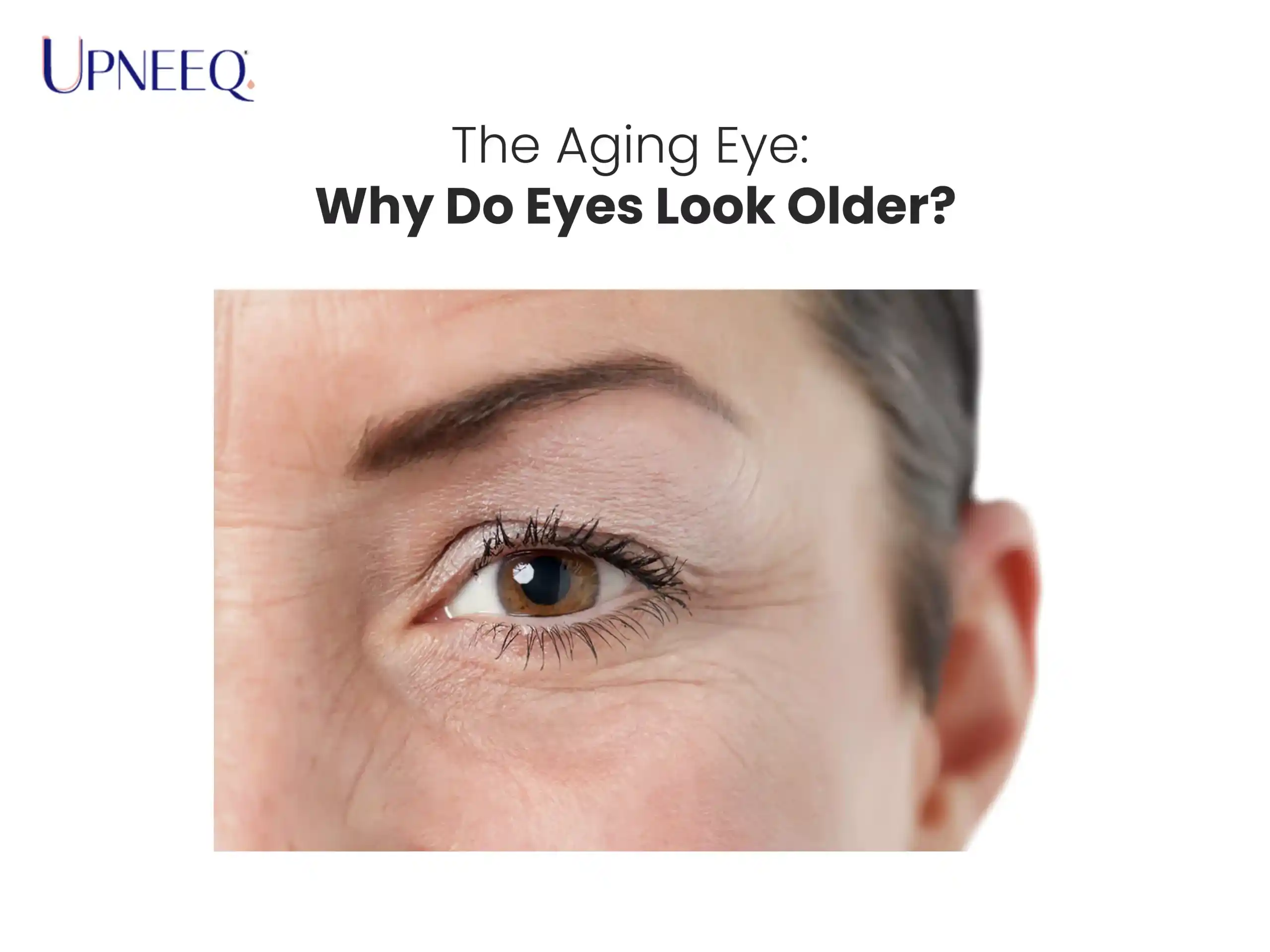 The Aging Eye: Why Do Eyes Look Older