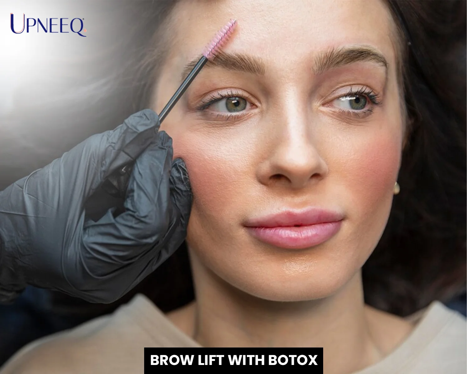 Brow Lift with Botox