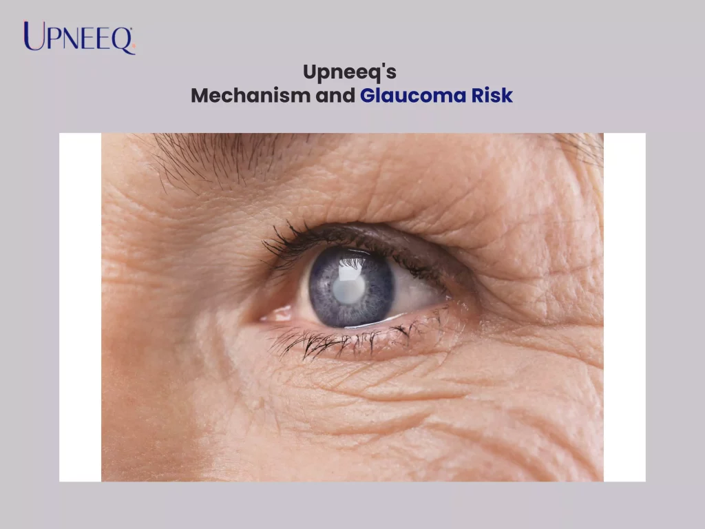 Upneeq's Mechanism and Glaucoma Risk