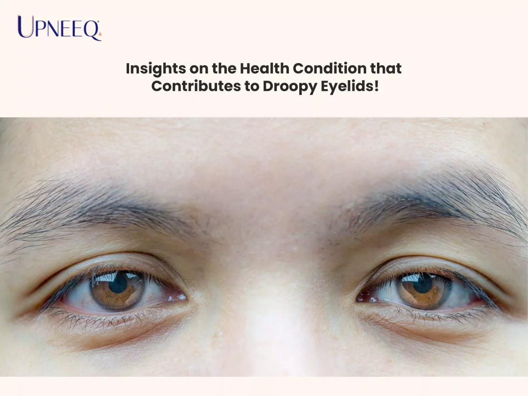 Insights on the Health Condition that Contributes to Droopy Eyelids!