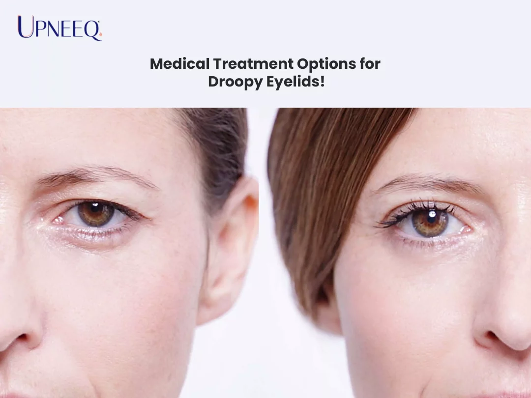 Medical Treatment Options for Droopy Eyelids!