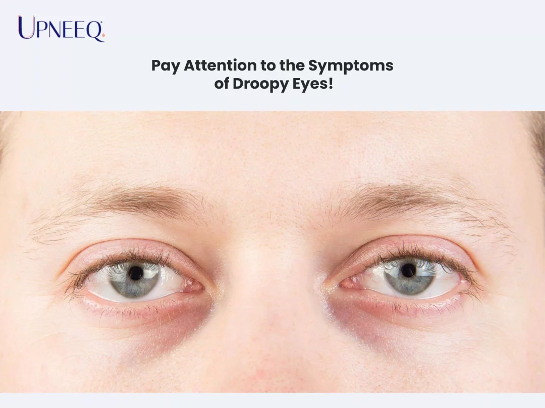 Pay Attention to the Symptoms of Droopy Eyes!