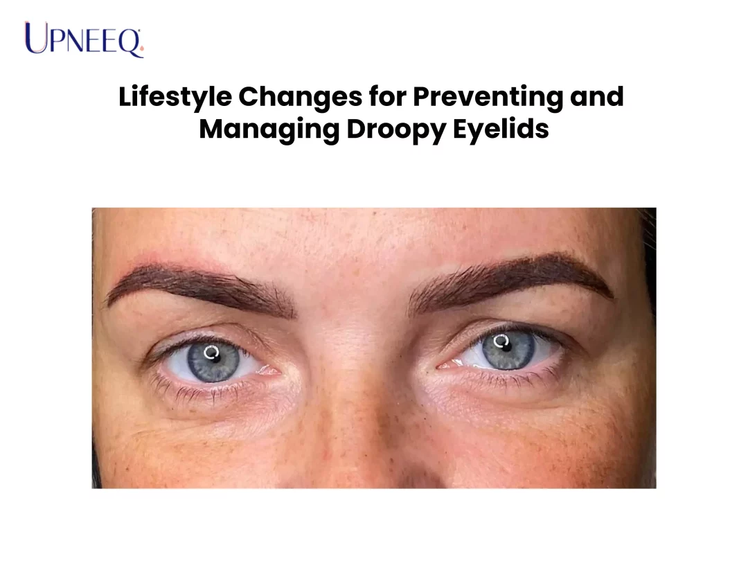 Lifestyle Changes for Preventing and Managing Droopy Eyelids