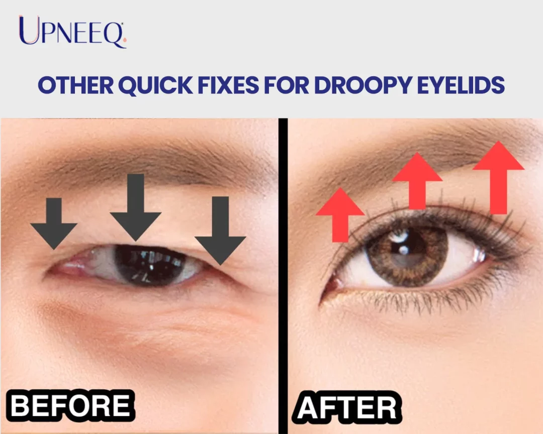 Other Quick Fixes for Droopy Eyelids