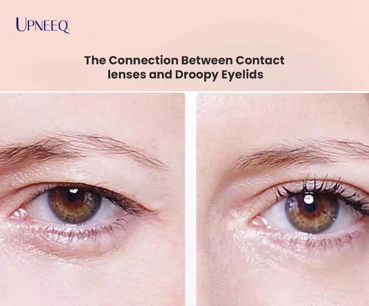 The Connection Between Contact lenses and Droopy Eyelids